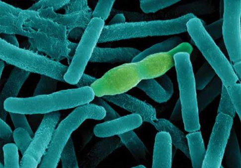 Σπάνιο κρούσμα άνθρακα σε αγρότη της Ελασσόνας